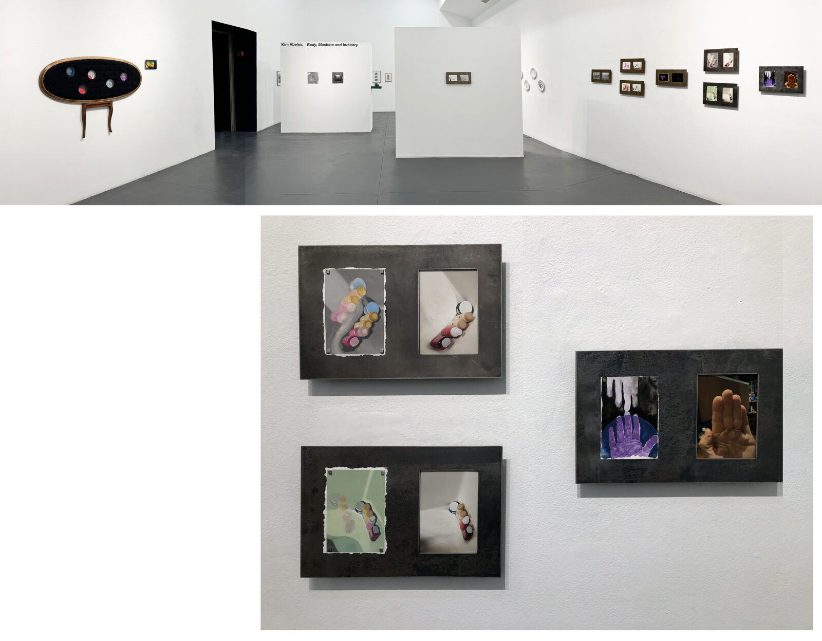 The "Vue" series are gouache paintings mounted on fabricated steel frames, and present observations seen from the damaged eye following surgeries, juxtaposed with the camera’s view of the same scene. 